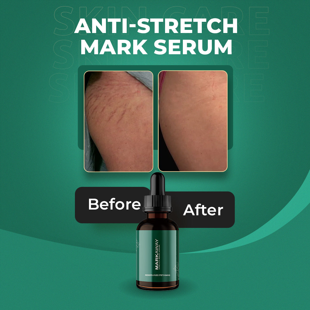 Markaway Stretch Mark Serum